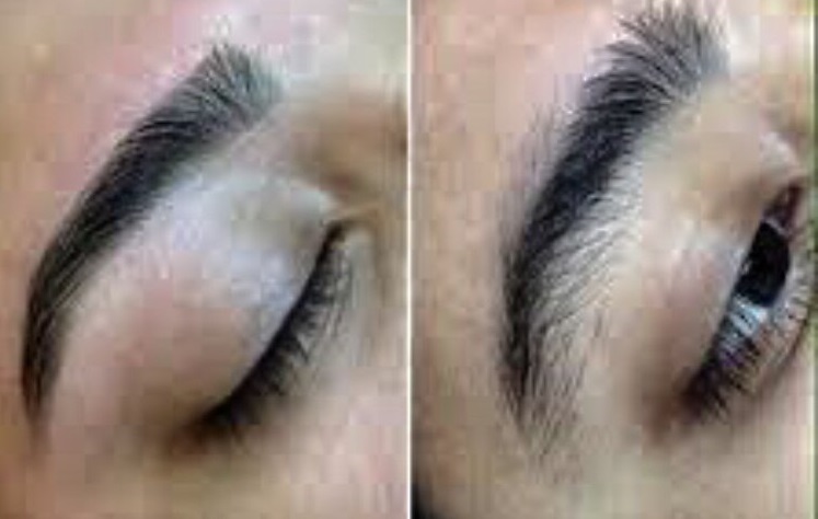 eyethreadingimage